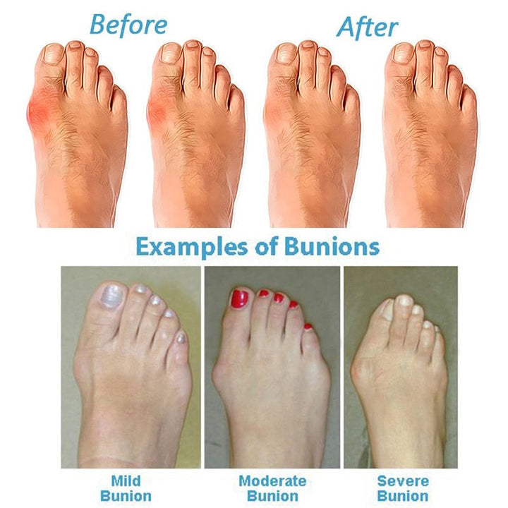 Women's Orthopedic Corrective Sandals for Comfort
