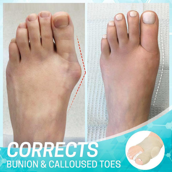 Dr. Healthy Bunion Correction Sleeve