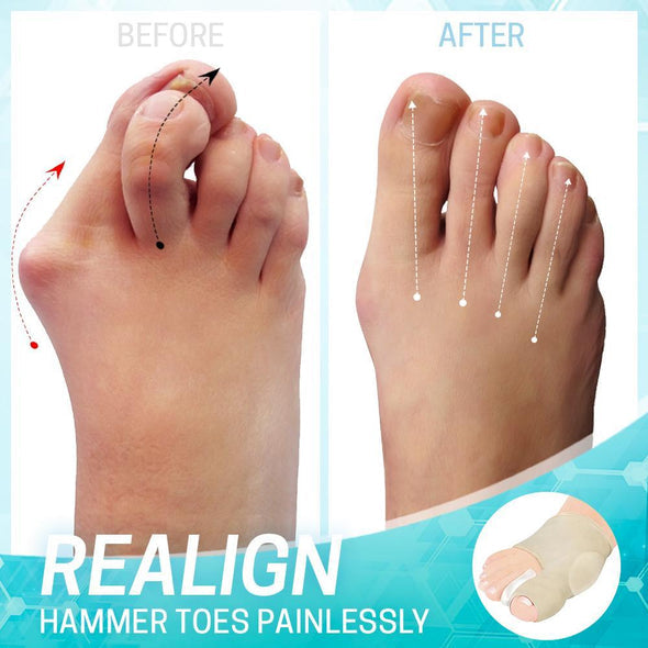 Dr. Healthy Bunion Correction Sleeve