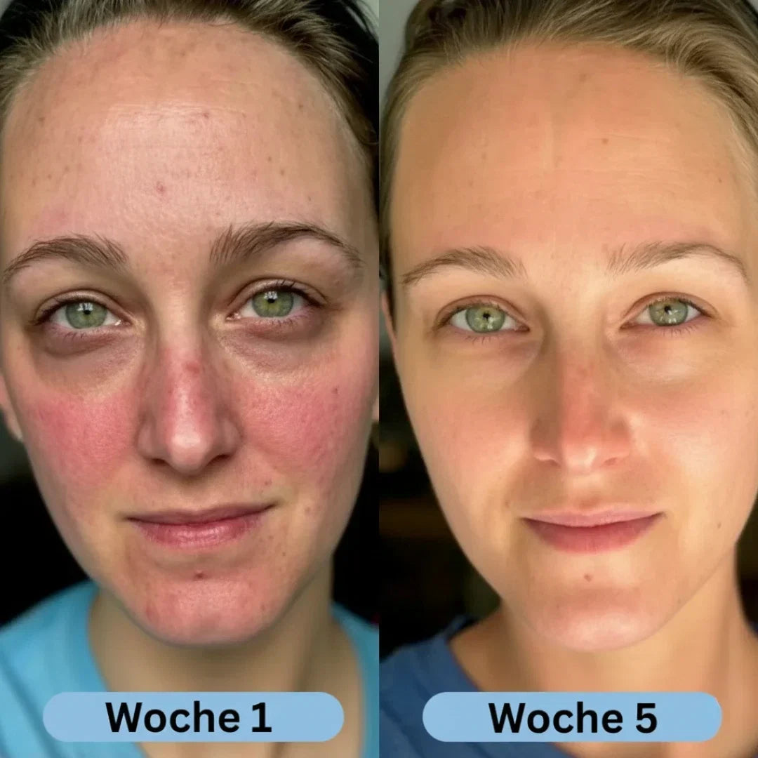 HautVolumen™ Korean Collagen Serum for Mature Skin