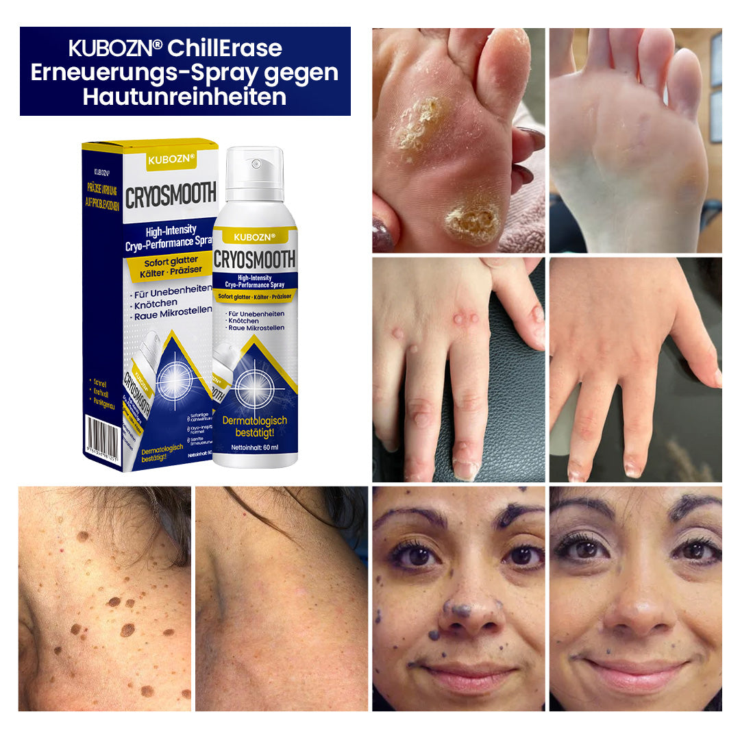 HautGlatt™ Cryo Precision Spray for Skin Imperfections