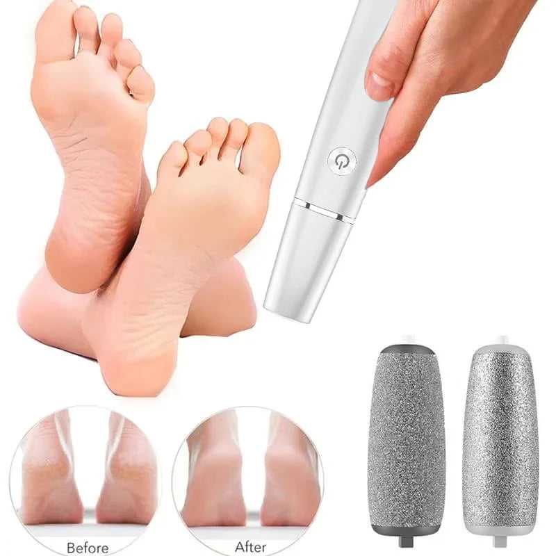 CallusRemove Electric Callus Remover for Soft & Smooth Feet [], view 4 - Elena Harper
