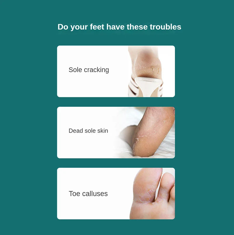 Effective Foot Care | Tool for Removing Calluses and Dead Skin