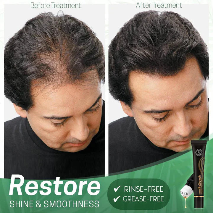 1+1 Free | NextGrow™ | Give Your Hair New Shine and Strength