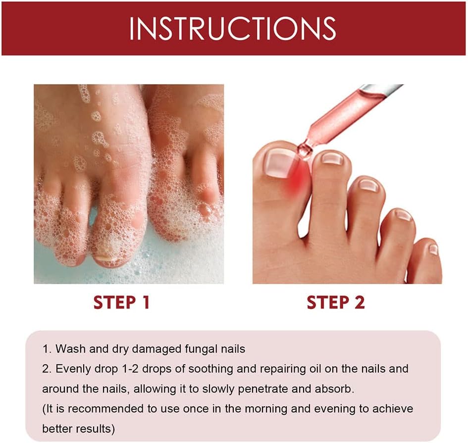 HealDrop™ – Effectively repairs damaged, brittle nails in just 4 weeks [1 + 1 Free]