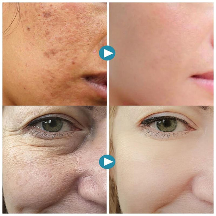 1+1 Free | SmoothPores™ Instant Pore Minimizer