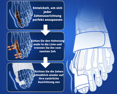 Flex-Bunions Corrector - Save Your Toe Before It's Too Late!