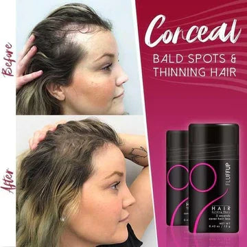 1 + 1 Free | HairMagic™ Prevents Bald Spots | Last Day Discount