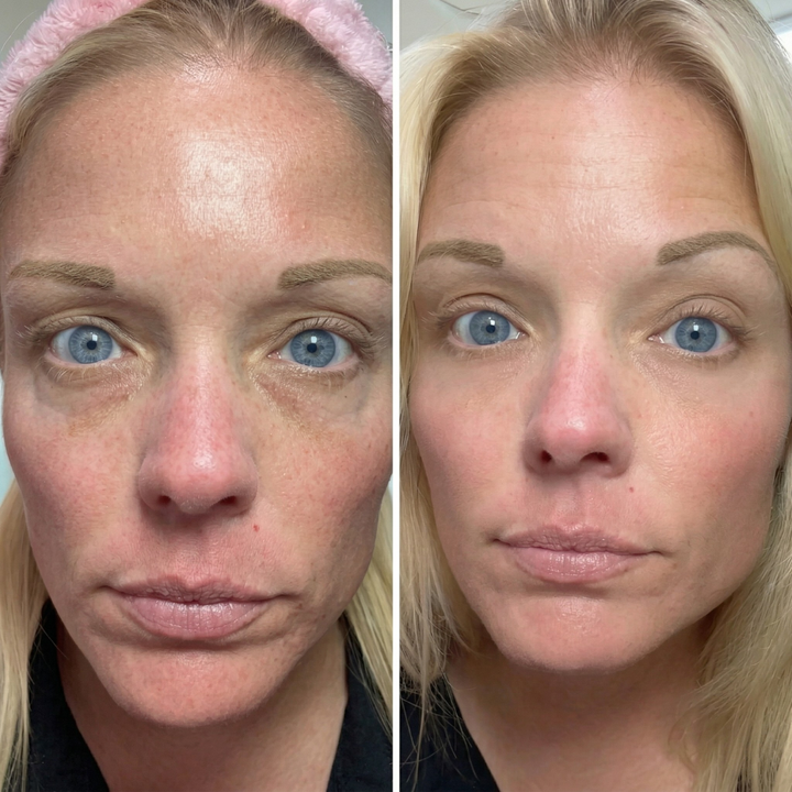 Eye Balm for Dark Circles