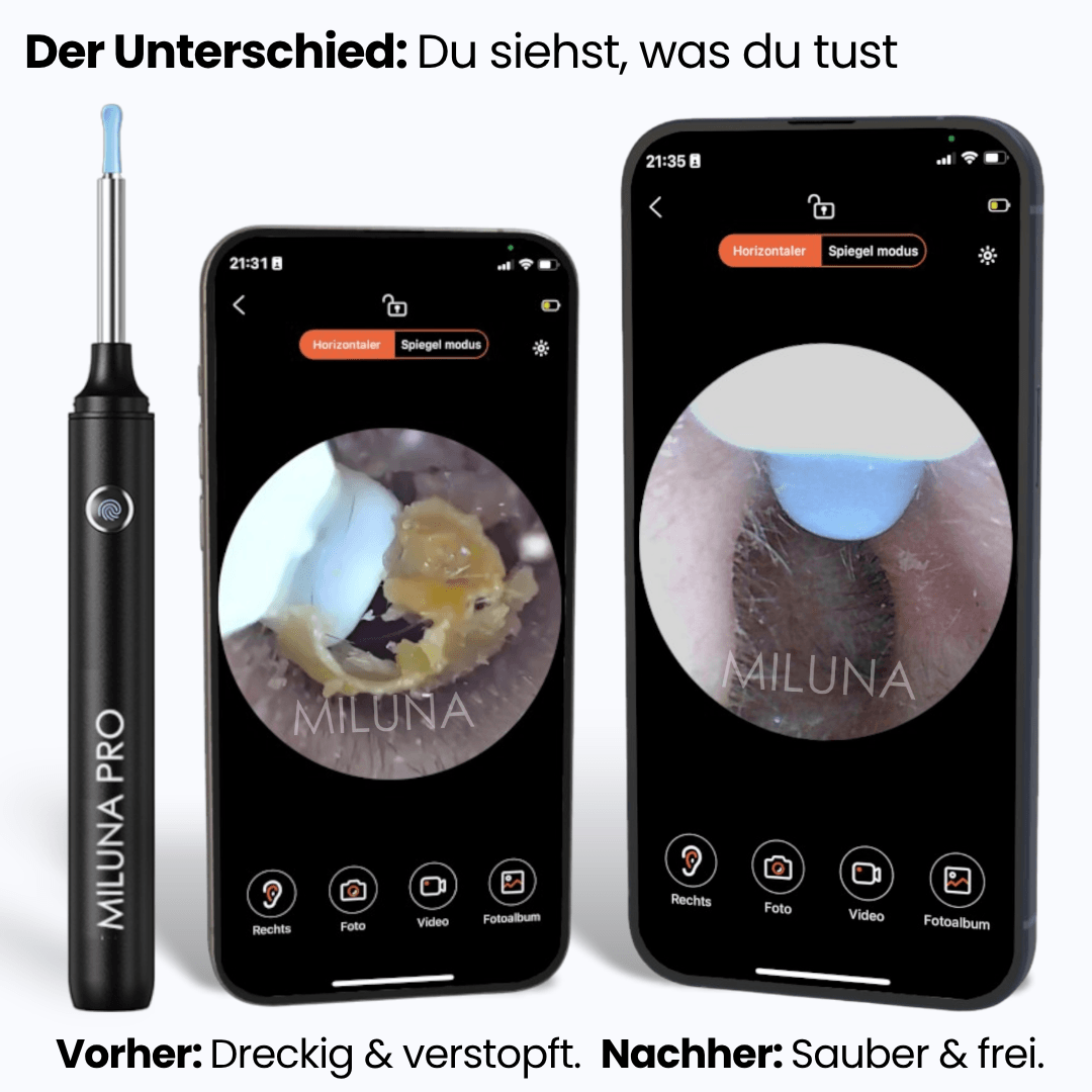 Earvia™ – Precise Ear Cleaner with Camera for Gentle Care