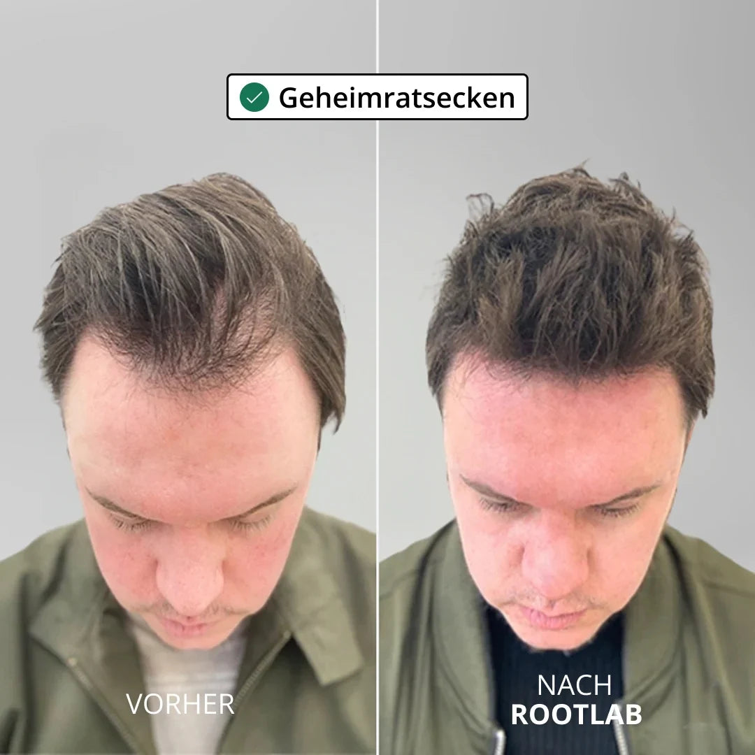 HairViva™ Hair Growth System for Stronger and Thicker Hair