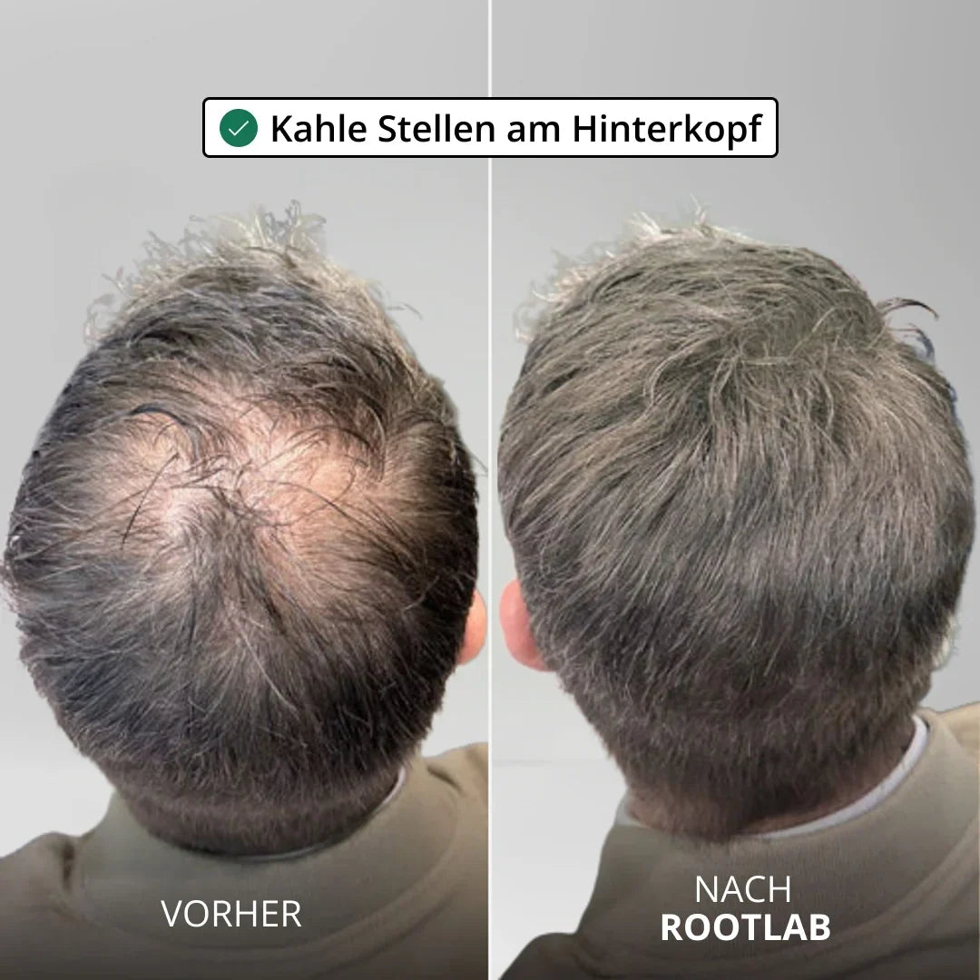 HairViva™ Hair Growth System for Stronger and Thicker Hair