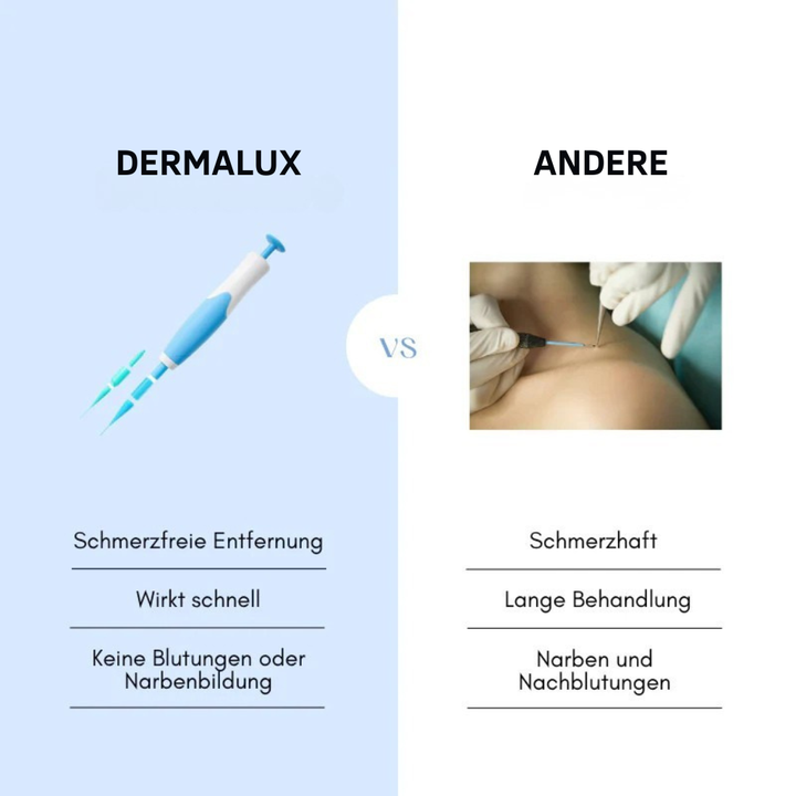 Dermalux® | Never Again Skin Tags