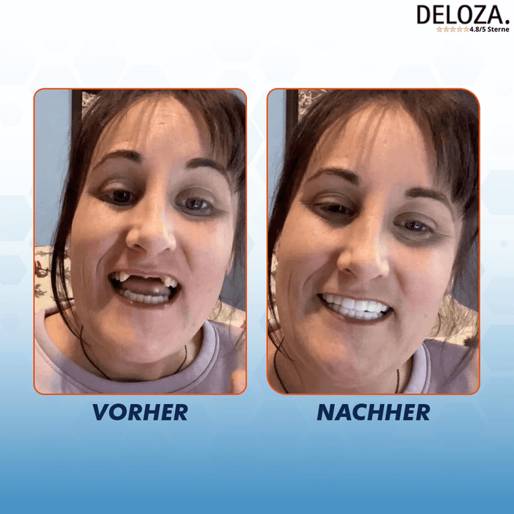 DentureBite™ – For a Naturally Appearing, Confident Smile [50% Off]