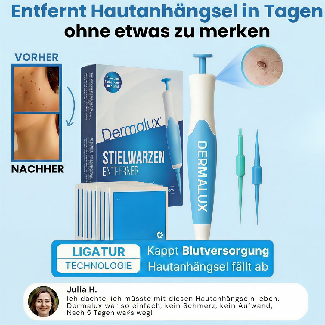 Dermalux® | Never Again Skin Tags