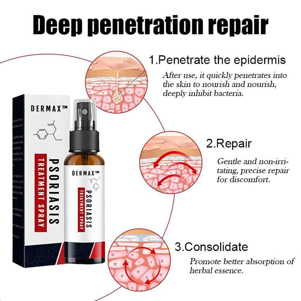 Dermax™ Psoriasis Spray