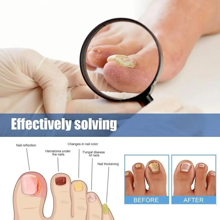 FungalPatch Antibacterial, Anti-Fungal Patch for Effective Nail Care [], view 8 - Elena Harper