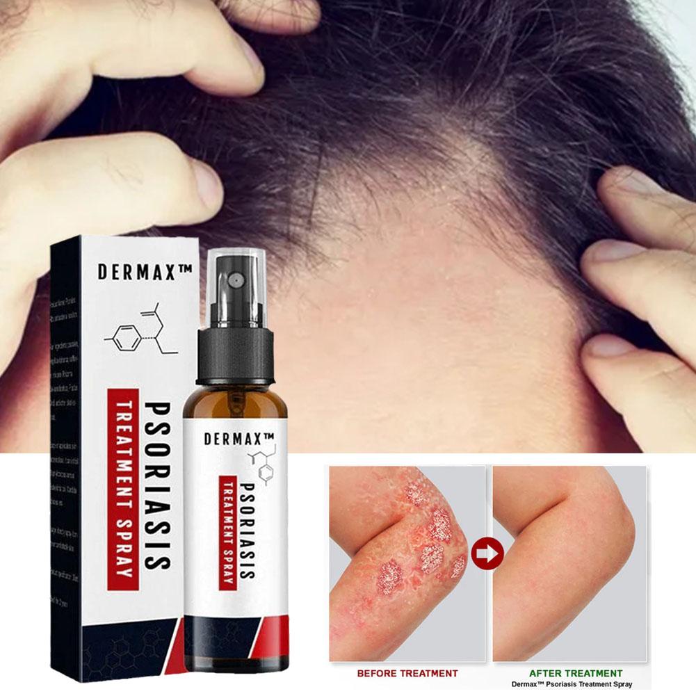 Dermax™ Psoriasis Spray