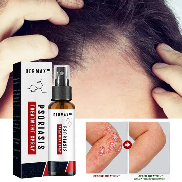 Dermax™ Psoriasis Spray