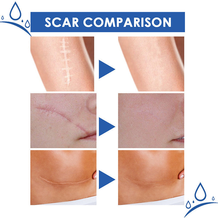 DermalSync™ – For Scar Reduction, Firming, Care, Regeneration & Smoother Skin [50% Off]