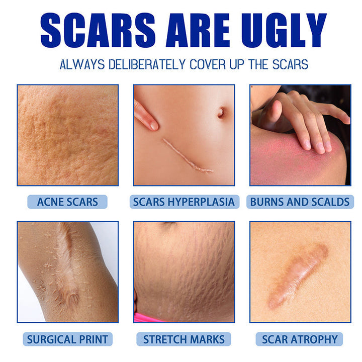 DermalSync™ – For Scar Reduction, Firming, Care, Regeneration & Smoother Skin [50% Off]