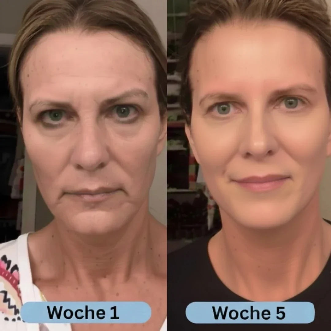 HautVolumen™ Korean Collagen Serum for Mature Skin