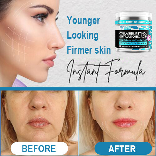 Youth Cream™ Smooths Fine Lines