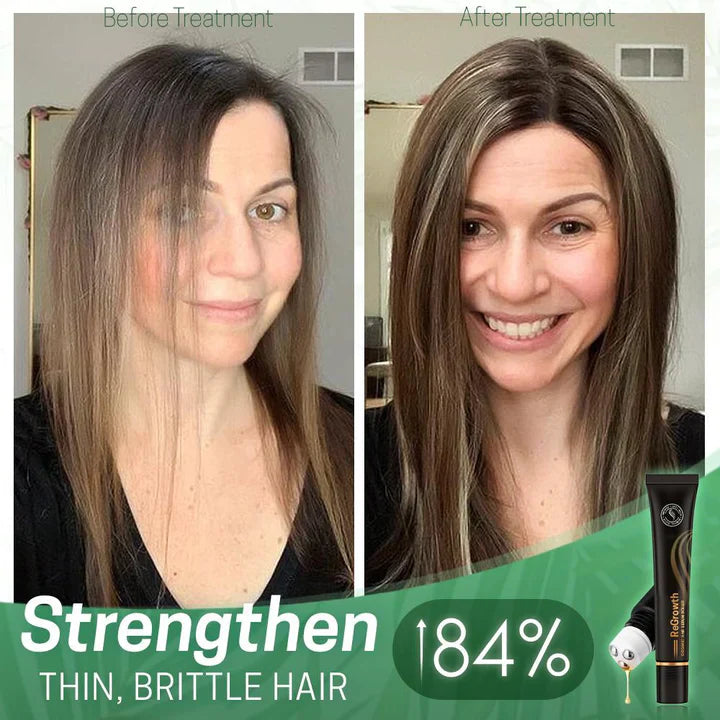 1+1 Free | NextGrow™ | Give Your Hair New Shine and Strength