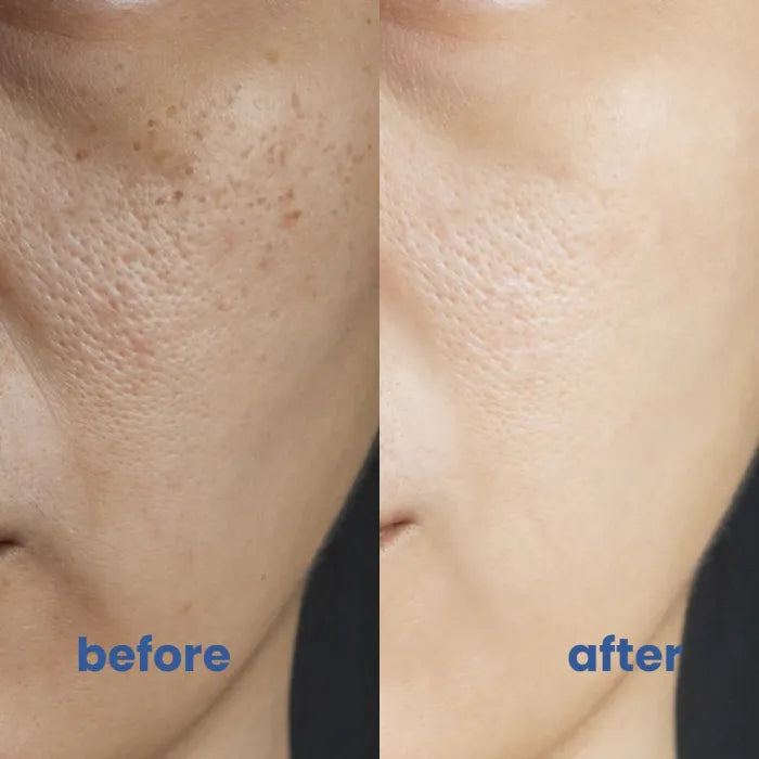 EvenTone Color Refining Radiance, view 6 - Elena Harper