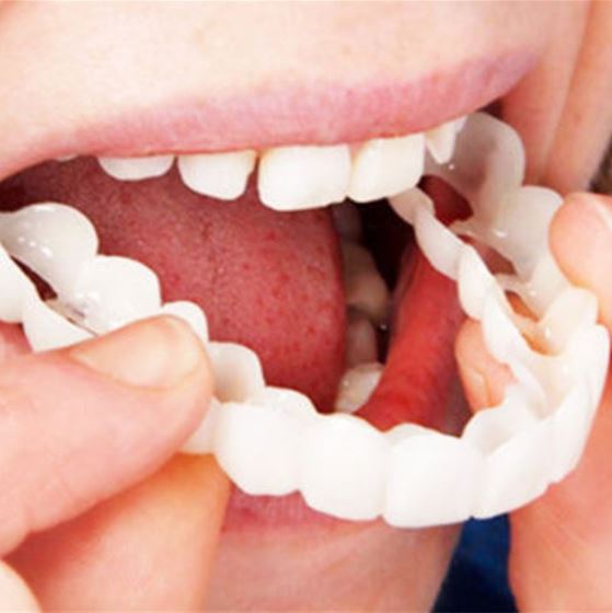 Simple Snap™ Snap-On Dentures