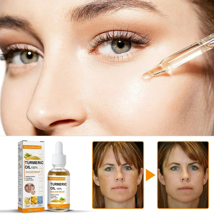 1+1 FREE | Golden Glow™ Reduces Dark Spots
