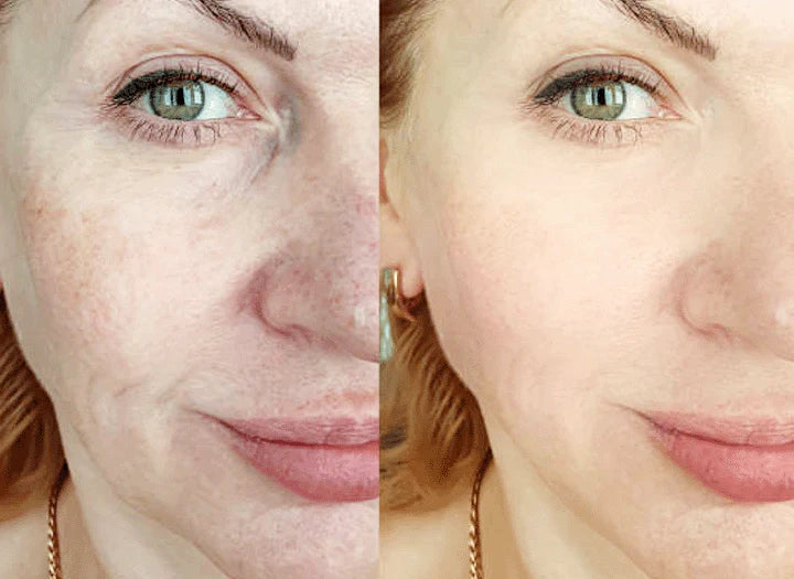 GlowEssence™ Brightening Skin Solution (Buy 1 Get 1 Free)