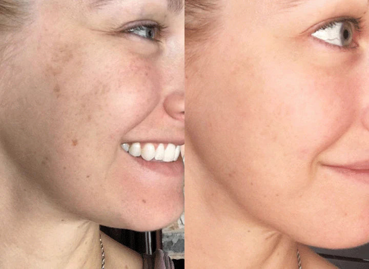 GlowEssence™ Brightening Skin Solution (Buy 1 Get 1 Free)